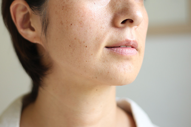 肌の黄ぐすみを改善するスキンケア！顔だけ黄ばみの原因や治し方