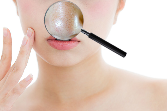 鼻とかに角栓ない人の肌は何が違う？角栓の原因って？