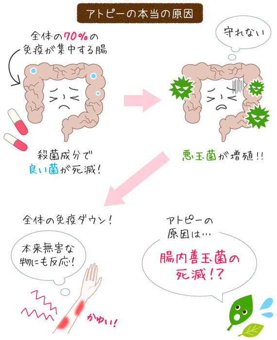 アトピーの本当の原因は、抗生物質、保存料、防腐剤、残留農薬、酸化防止剤などによる、腸内の善玉菌の殺菌では？