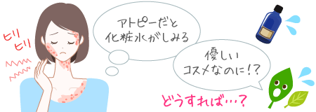 アトピーだと、化粧水がヒリヒリとしみる！