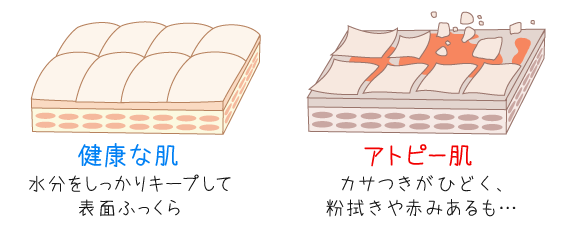 健康な肌とアトピー肌の表面