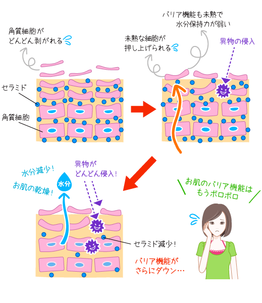 刺激の強いスキンケアを続けると肌が弱くなる