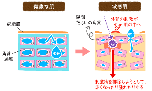 健康な肌と敏感肌