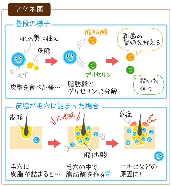 アクネ菌の役割と働き