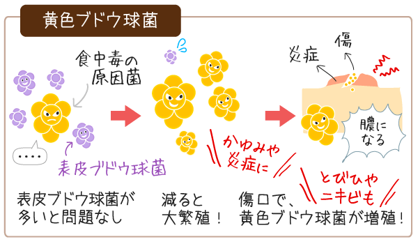 黄色ブドウ球菌のお肌への影響