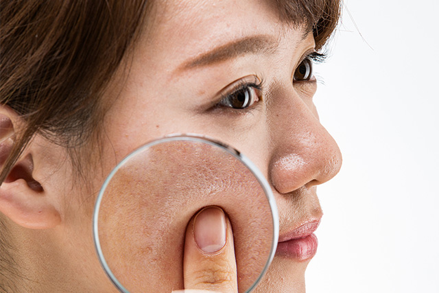 顔のくすみを改善する5つのスキンケア対策