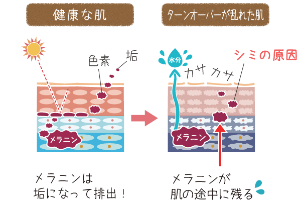 健康な状態の肌ではメラニンは垢になって落ちて行くが、ターンオーバーが乱れたお肌の場合、メラニンがお肌に居座ってしまう