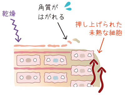 不全角化を起こしたお肌