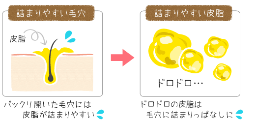 問題は「詰まりやすい毛穴」と「詰まりやすい皮脂」