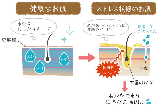 健康なお肌とストレス状態のお肌