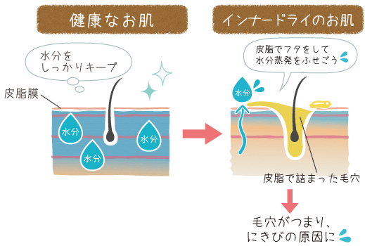 健康なお肌とインナードライの肌