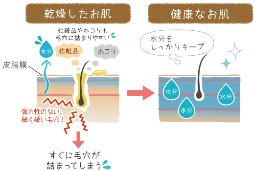 乾燥したお肌と健康なお肌