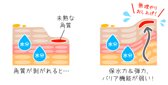 角質剥がれが続くと、未熟な細胞が肌表面に