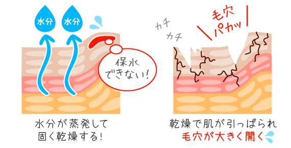 未熟な角質細胞は保水力が弱く弾力がないため、固く乾燥して毛穴が開く