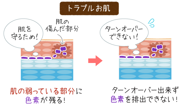 トラブル肌とメラニン色素