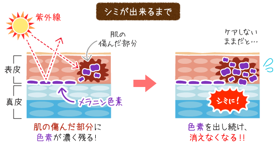 シミが出来るまで