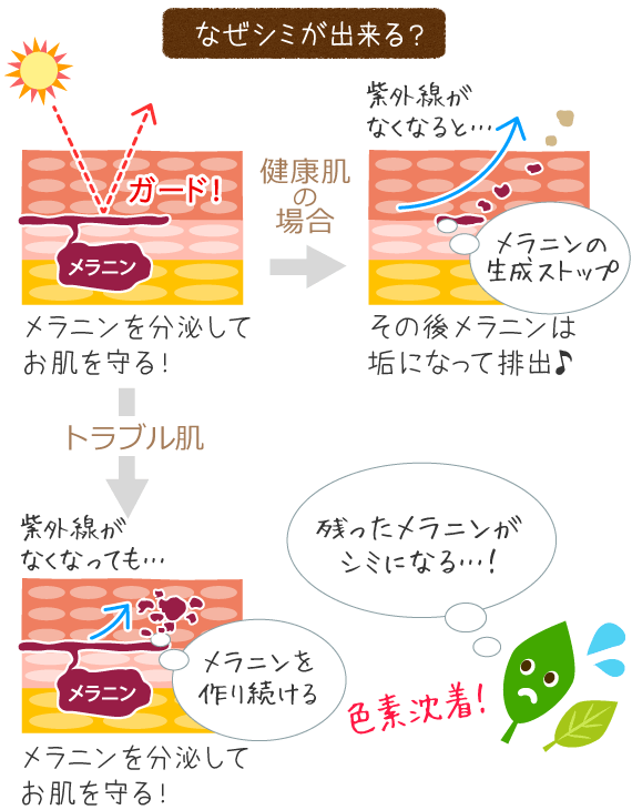 なぜ、シミやそばかすになるの？