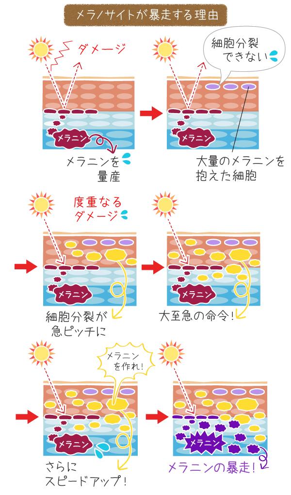 メラノサイトが暴走する理由をチャートで説明