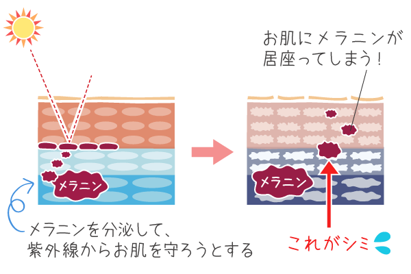 お肌に居座ったメラニンがしみになる