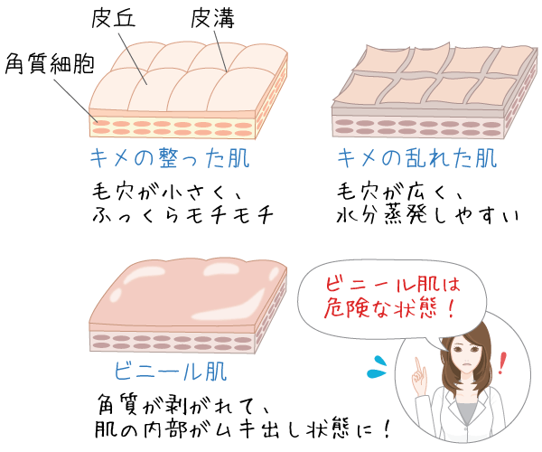 ビニール肌とはどんな見た目？簡単な見分け方や特徴は？