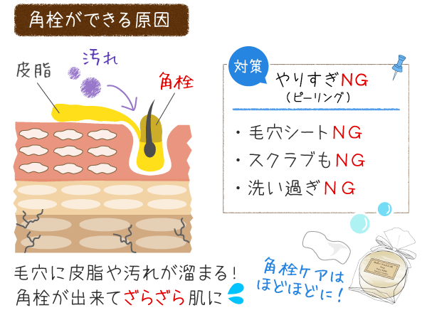 角栓の原因と対策