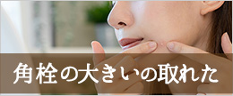 角栓の大きいの取れた！大きな角栓を取った後に穴が空いた時のケア