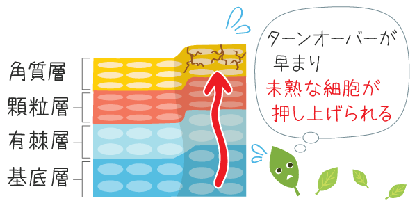 不全角化は、ターンオーバーが早まり未熟な細胞が表面に押し上げられた状態。